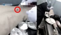 Pemuda di Nabire Alami Luka Tusuk Saat Naik Motor di Jalan Ampera