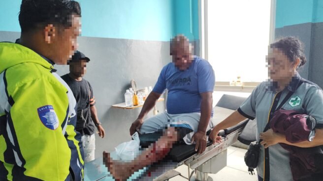 Karena Lampu Merah Tak Menyala dan Kurangnya Kehati-hatian, Dua Motor Tabrakan di Kusuma Bangsa Nabire