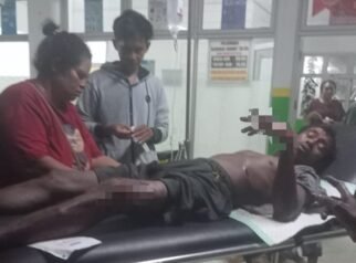 Seorang Warga Digigit Buaya Saat Mandi di Sungai Uwapa, Alami Luka Serius Hingga Dirujuk