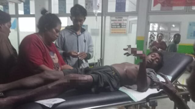 Seorang Warga Digigit Buaya Saat Mandi di Sungai Uwapa, Alami Luka Serius Hingga Dirujuk