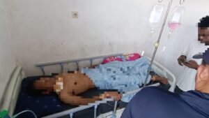 Warga Jadi Korban Penganiayaan Berat di Dekai, Satgas Damai Cartenz Kejar Pelaku