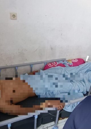 Warga Jadi Korban Penganiayaan Berat di Dekai, Satgas Damai Cartenz Kejar Pelaku